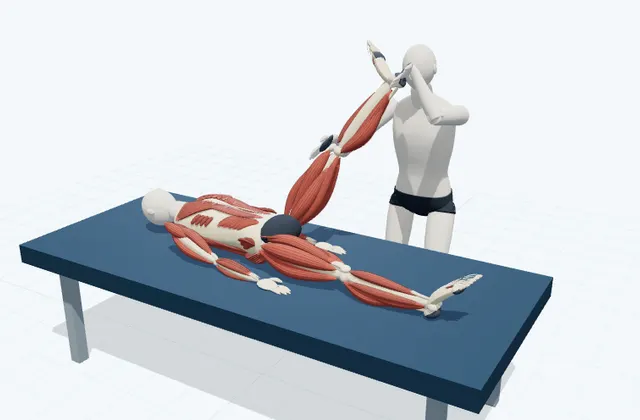 A schematic 3D view of Medial Hamstring Bias